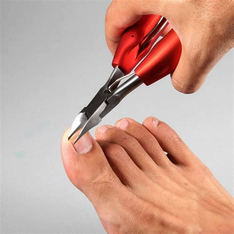 ingrown nail cutter|best med for ingrown toenail.